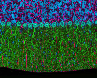 Illustration for article titled The Alien and Eerie Beauty of the Year's Best Microscopic Photos